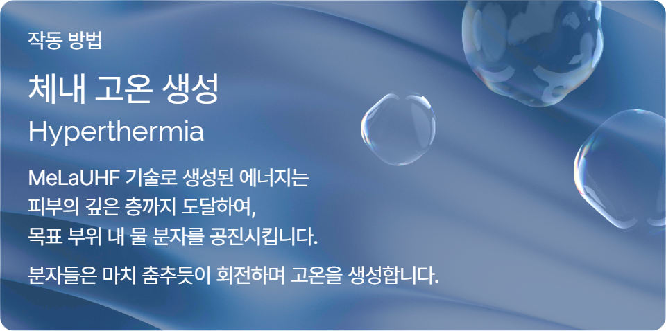 맥스웨이브 극초단파 장비